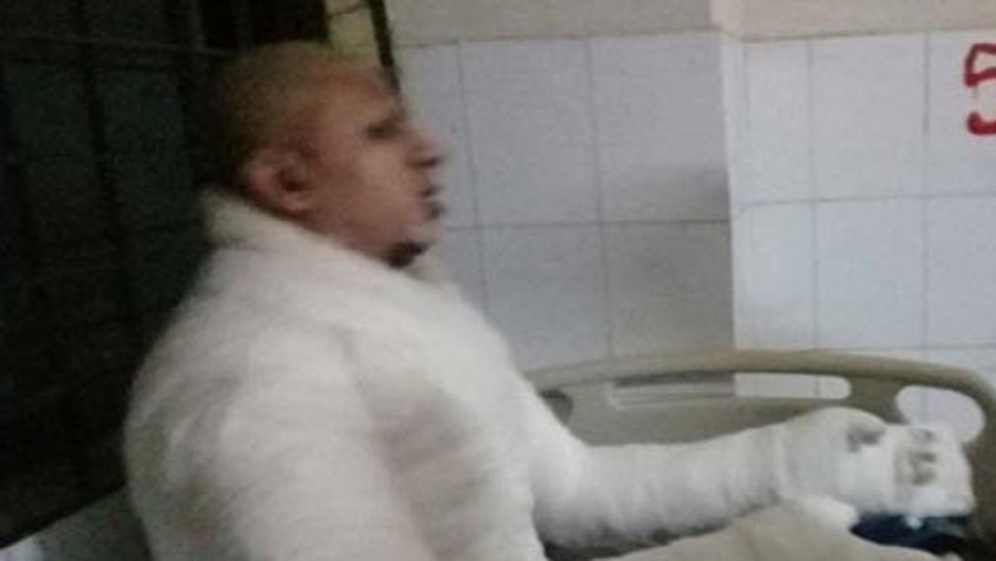 হালিশহর, ওয়ার্ডের সচিব, আগুনে দগ্ধ